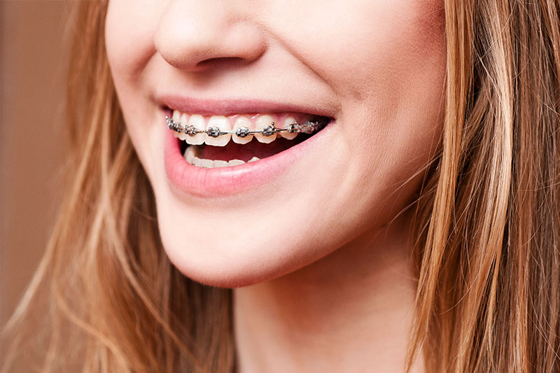 Orthodontics in Westminster